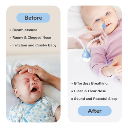 Flow Baby Nasal Aspirator 😴