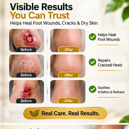 DermaHeal™ Blood sugar care spray